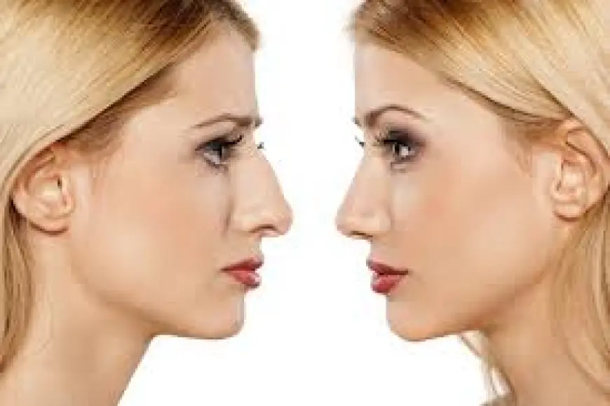 A New Nose, A New You: Understanding the Magic of Rhinoplasty