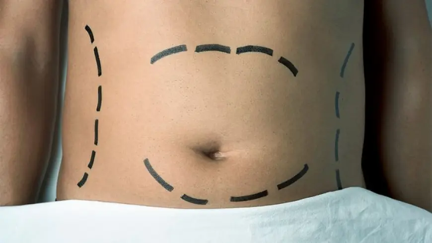 Mini Tummy Tuck Dubai: Quick Recovery