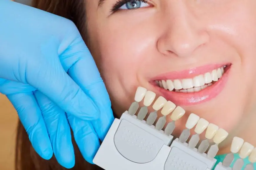 How Composite Veneers Can Improve Your Confidence Instantly
