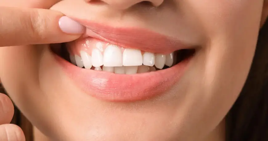 Laser Gingivectomy: Benefits and What to Expect