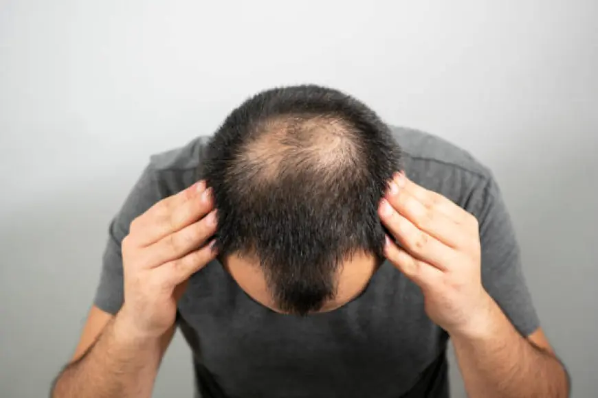 زراعة الشعر في الرياض: نتائج طبيعية وتألق دائم