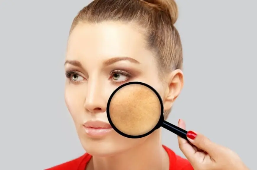 How To Remove Pigmentation From Face Permanently and Look Stunning