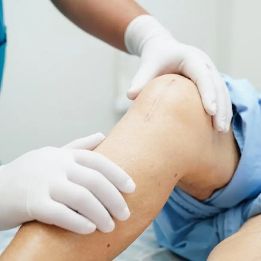 Top Misconceptions About Knee Replacement Surgery