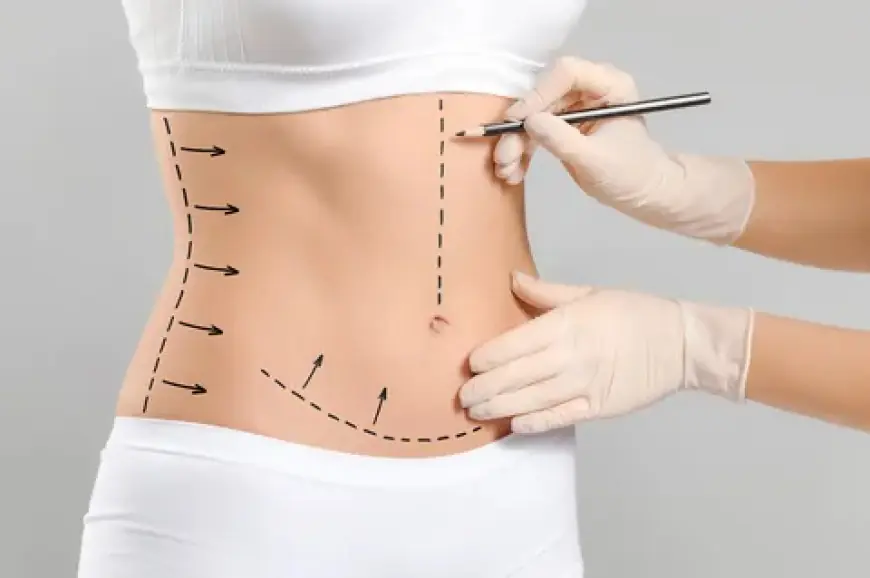 Liposuction Surgery: Risks, Benefits, and Recovery Explained