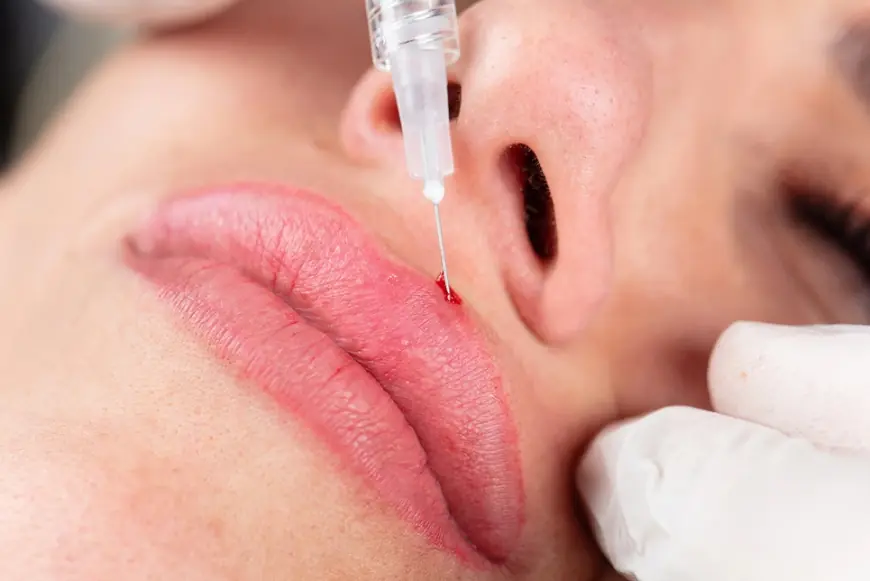 How to Communicate Your Lip Goals to a Practitioner?