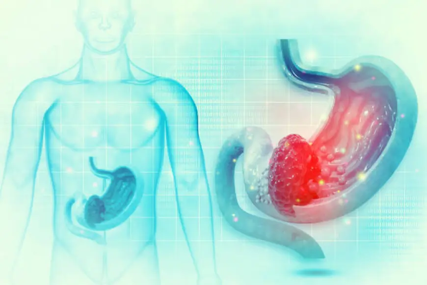 Choosing Your Gastric Balloon Center Riyadh