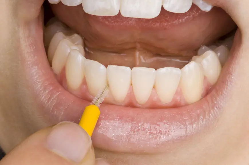 From Grime to Shine: Transform Your Smile with Proper Teeth Cleaning