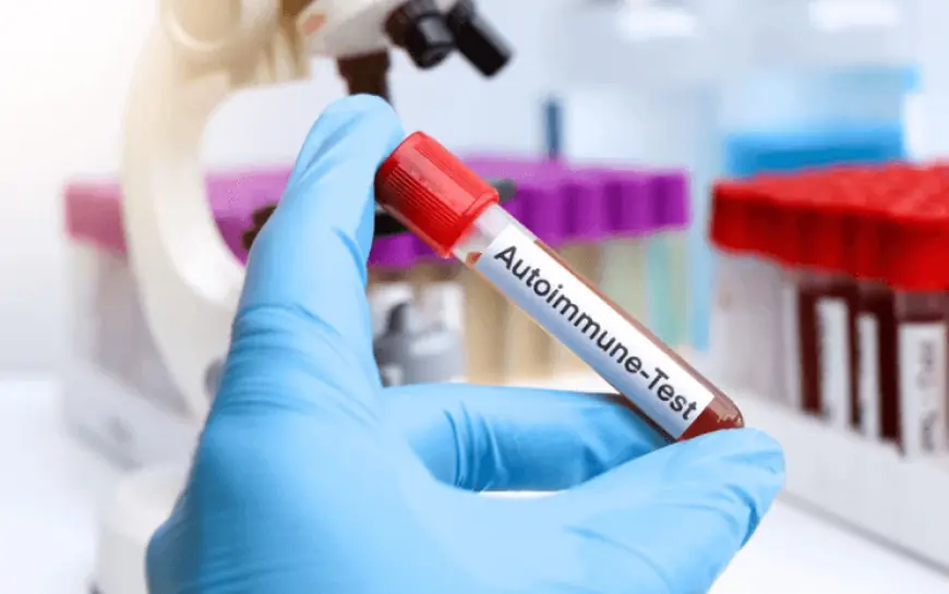 Blood Test at Home for Autoimmune Diseases: What’s Available?