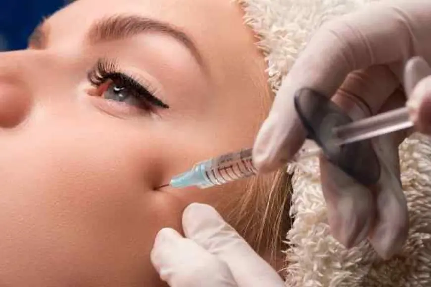 What Are the Benefits of Cheek Fillers Injections?
