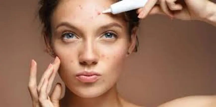 Tretiva 40 mg: The Strong Solution for Stubborn Acne
