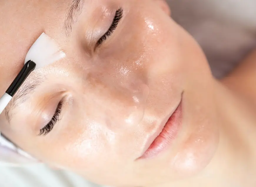 Chemical Peels for Fading Stubborn Dark Spots
