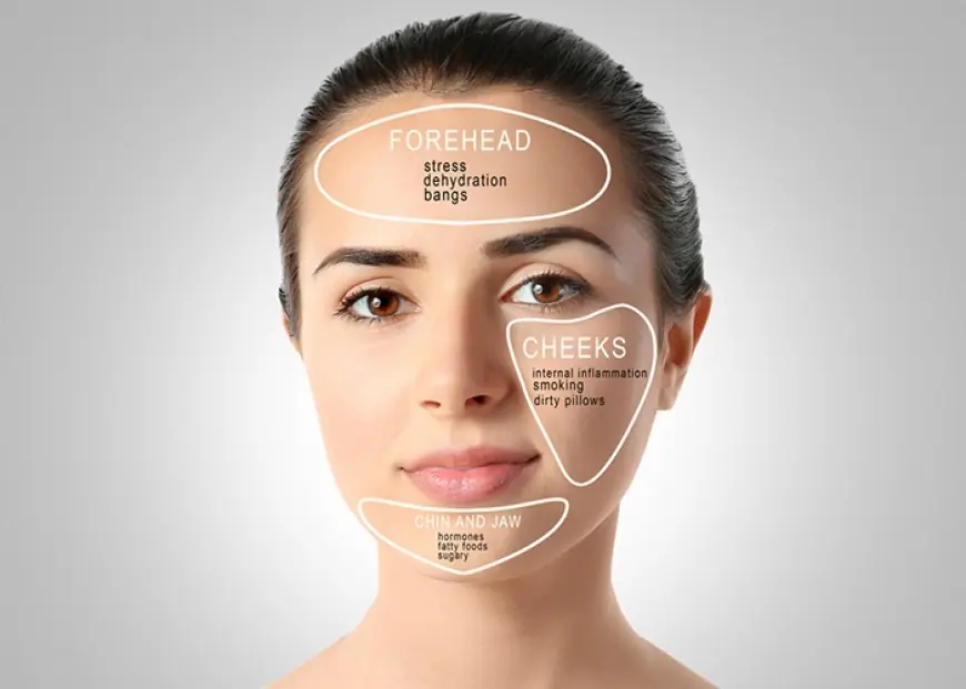 Acne Treatment: Clear Skin Starts Here with Influennz