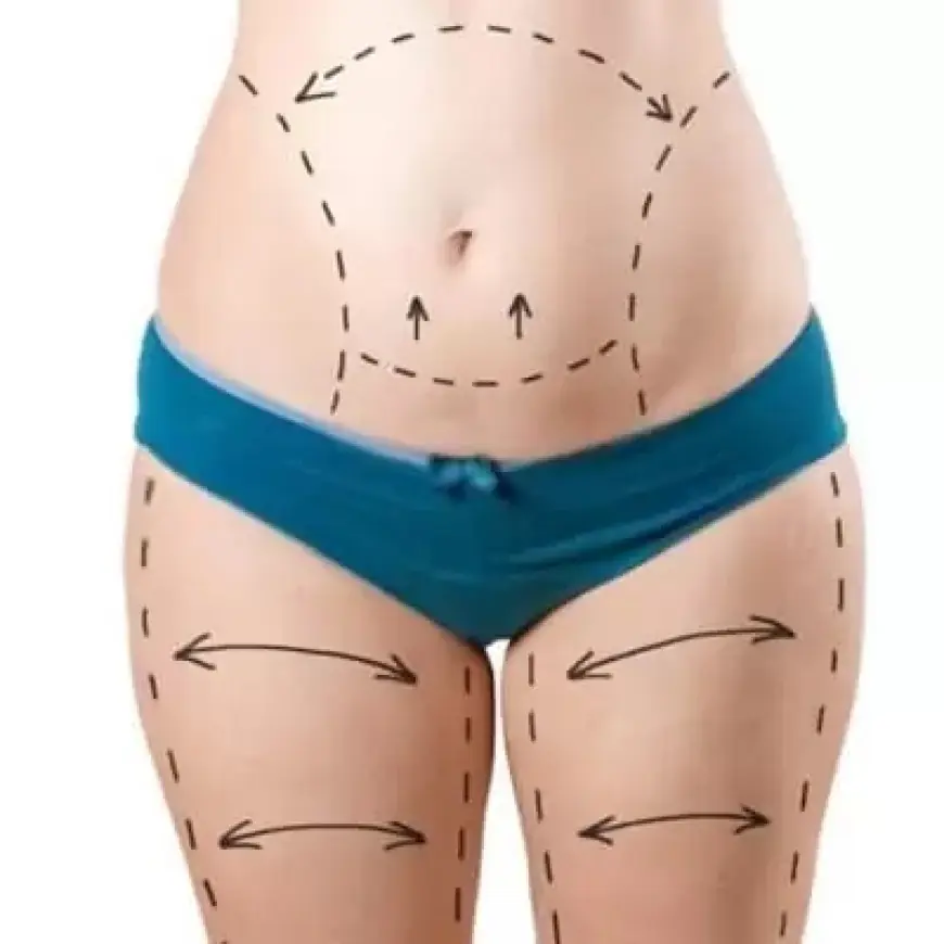 Exploring the Link Between Tummy Tuck in Dubai and Posture Improvement