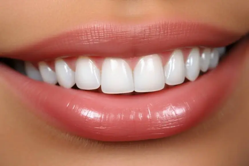 Preparing for a Big Event? Why Whitening Is the First Step
