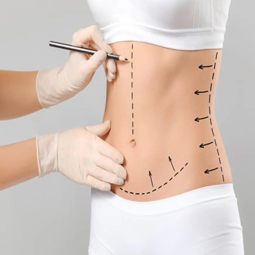 Mini Abdominoplasty in Dubai: What Happens During the Procedure?