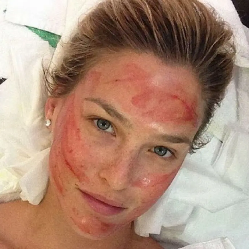 How Effective Is a Vampire Facial for Glowing Skin?