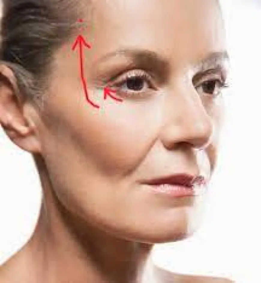 Can I Try Skin Tightening Before Considering Surgery?