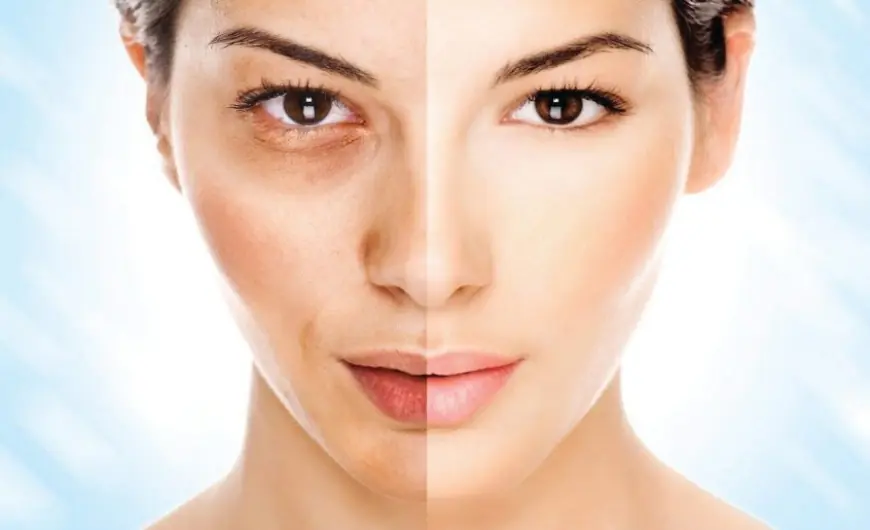 Birthmark Removal in Dubai for Kids and Adults: What’s the Difference?