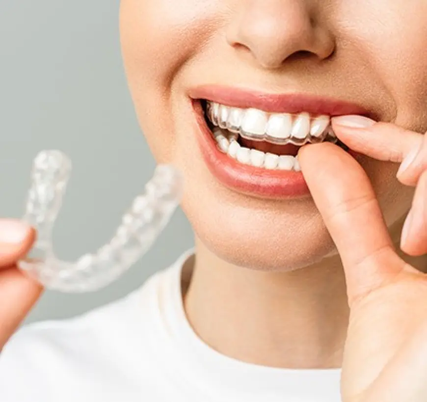 Discreetly Straighten Teeth Using Clear Aligners