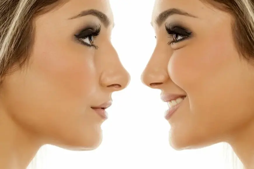 What is Ultrasonic Rhinoplasty and How Does It Work in Dubai?