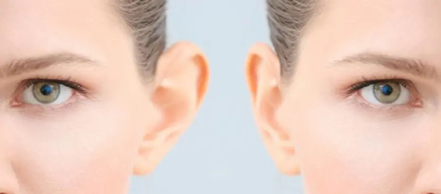 The Consultation Process Before You Reshape Protruding Ears in Islamabad