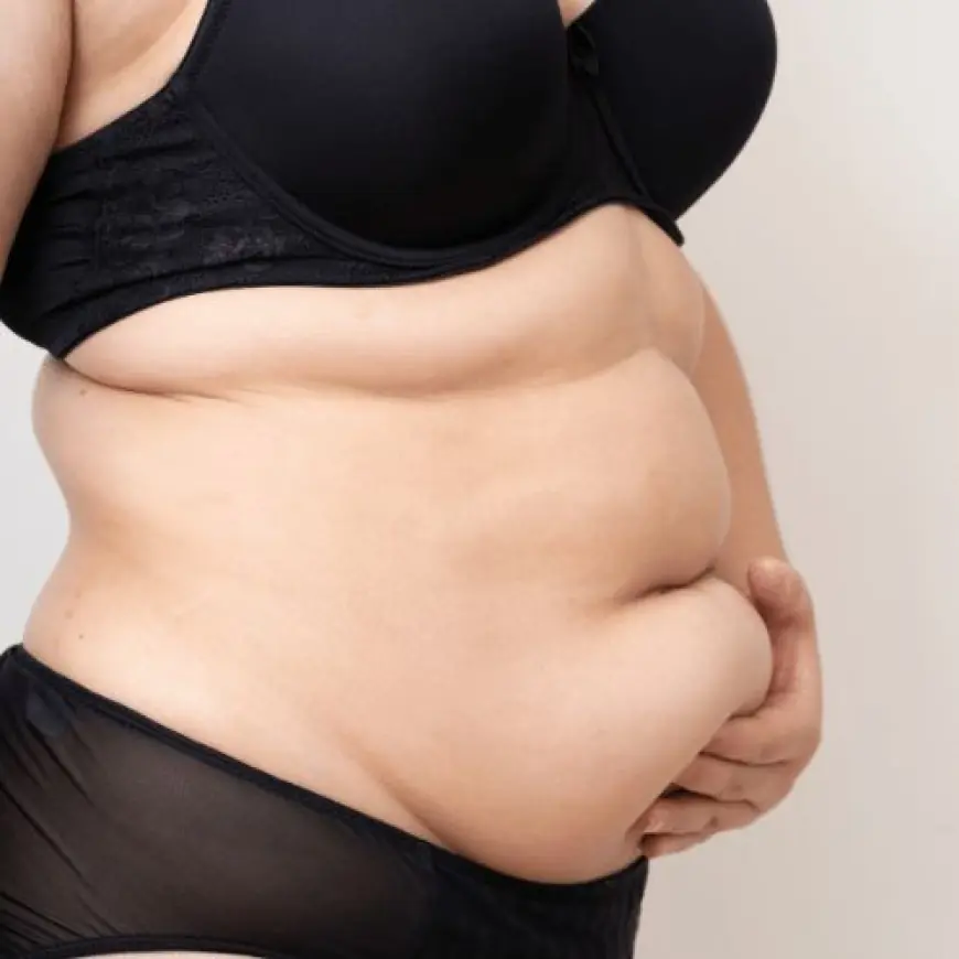 What Are the Latest Innovations in Liposuction Technology in Riyadh?