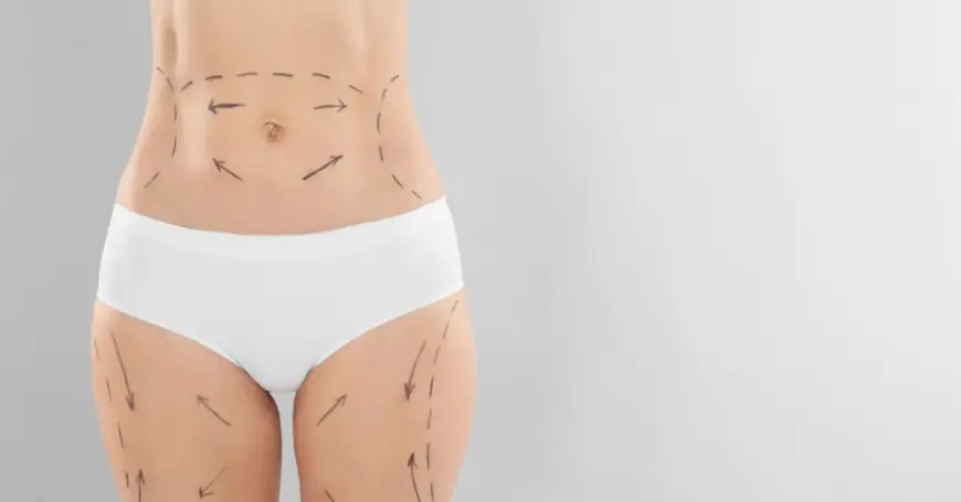 Best Time to Book a Tummy Tuck Surgery