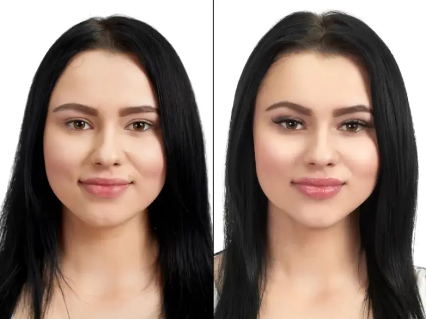 How to Prepare for Preservation Rhinoplasty in Dubai: A Step-by-Step Guide