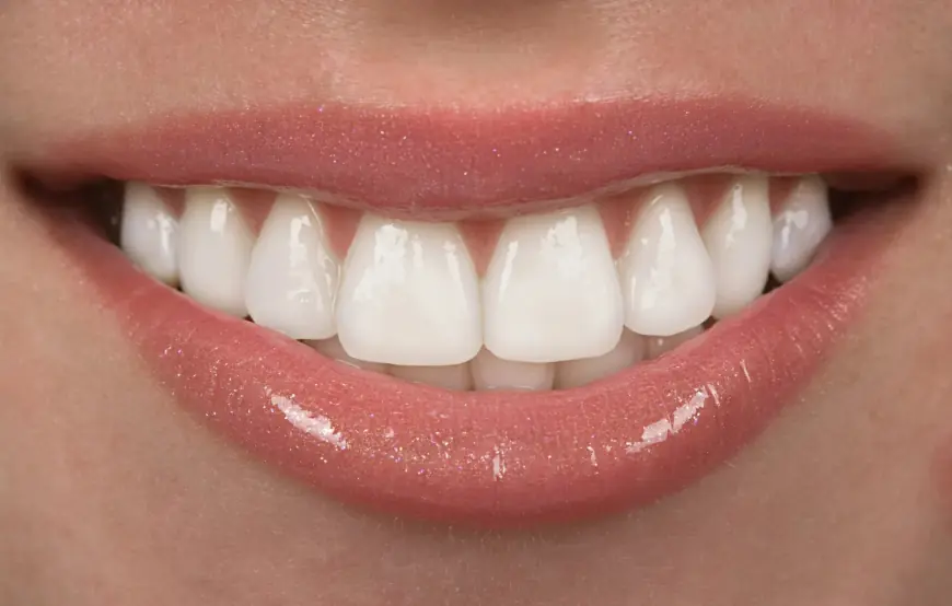 Are Composite Veneers Reversible? A Look at the Facts