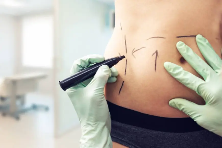What Are the Pre- and Post-Care Tips for Liposuction in Riyadh?