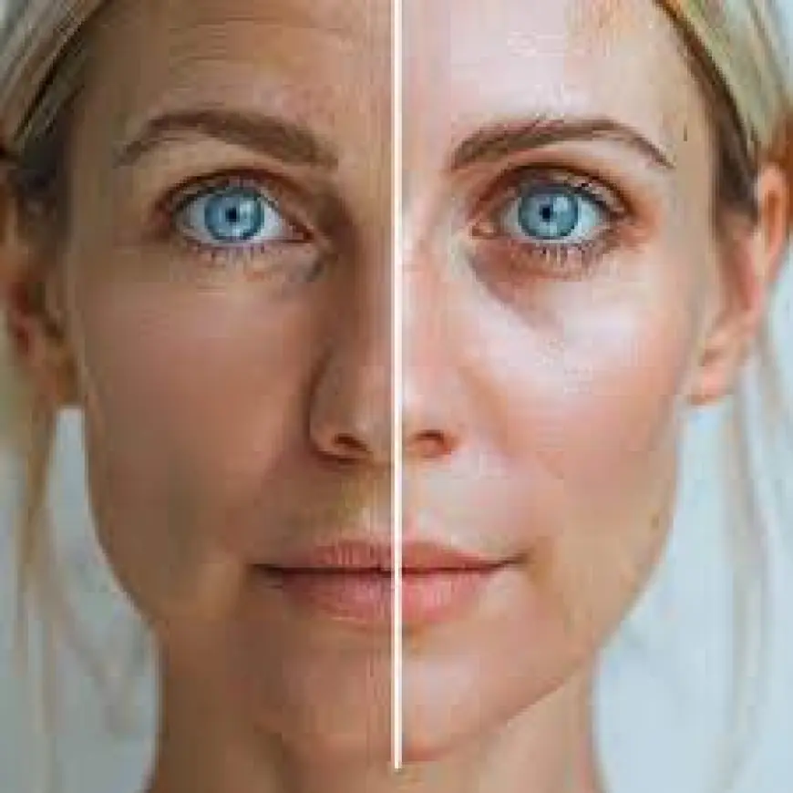 Is Skin Rejuvenation Covered by Insurance?