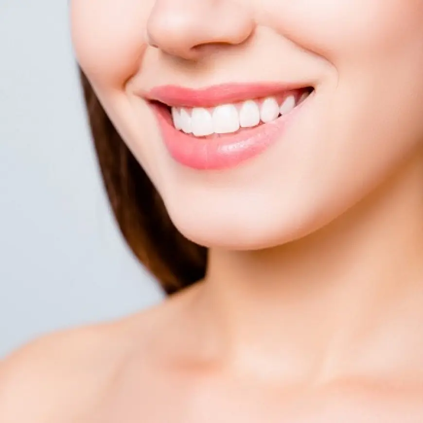 Can Botox Injections Fix Gummy Smiles Too?