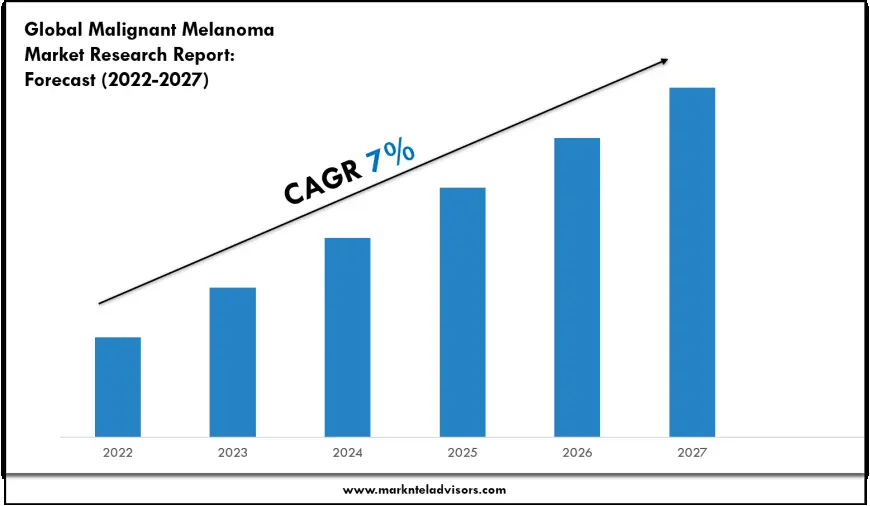 Malignant Melanoma Market Volume, Trends and Growth Outlook Report 2027