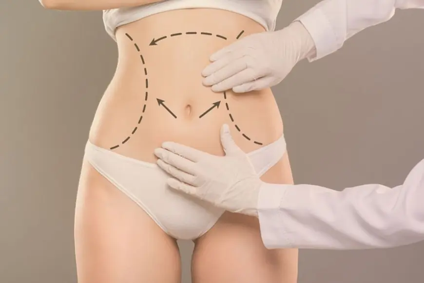 Tummy Tuck in Dubai for Weight Loss Patients: What to Know