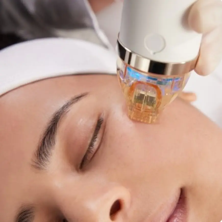 Erase Fine Lines & Acne Scars: The Power of Microneedling Treatment in Houston