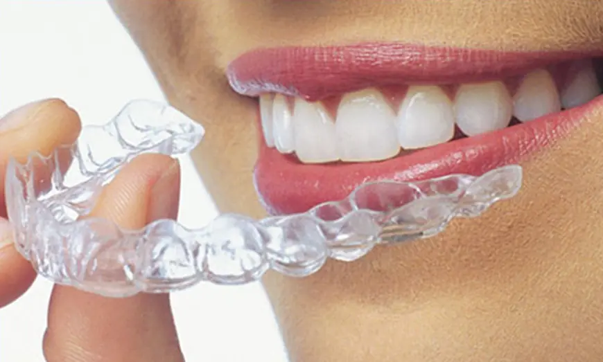 Aligners for Adults: It’s Never Too Late to Achieve a Perfect Smile