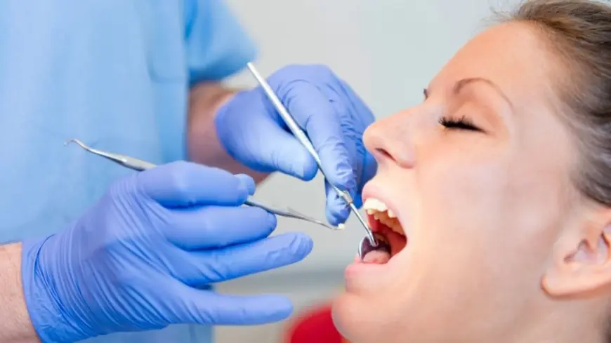 Can You Get a Cavity Under a Filling? Understanding Secondary Decay