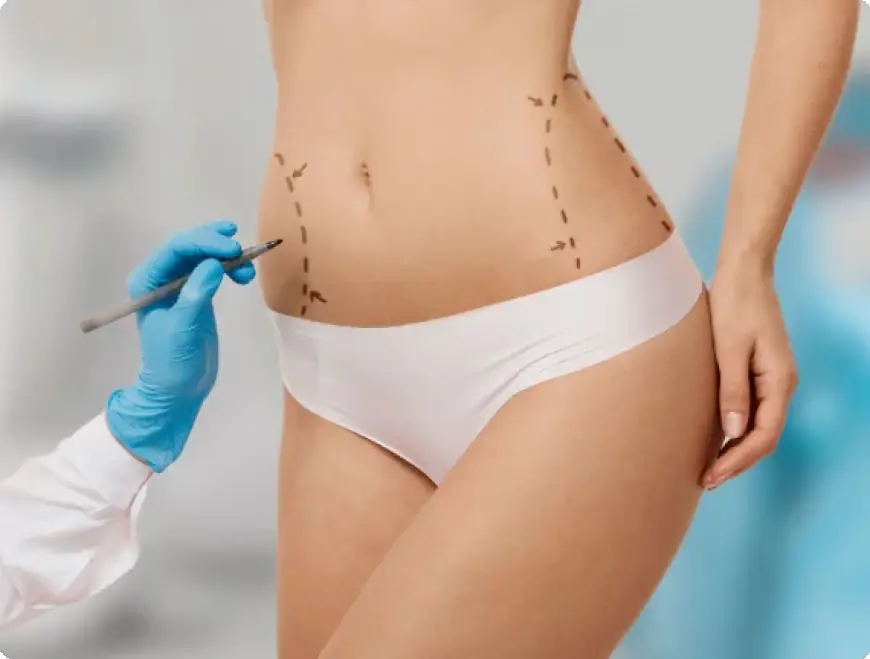 Can Tummy Tuck Surgery Help With Weight Loss?