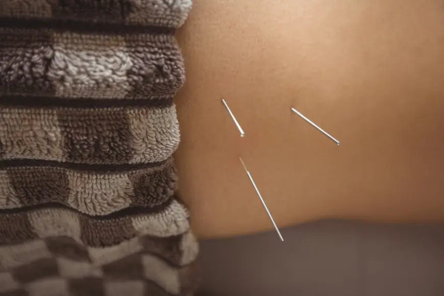 Chronic Pain, Meet Your Match: How Acupuncture Offers Lasting Relief in Phoenix, Arizona