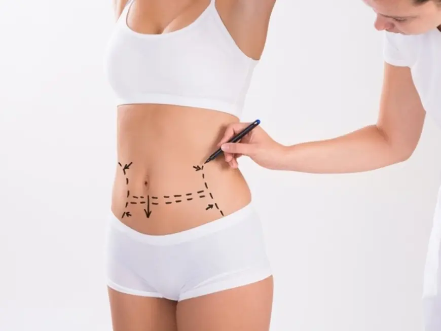 Before and After a Tummy Tuck in Islamabad: What Changes to Expect