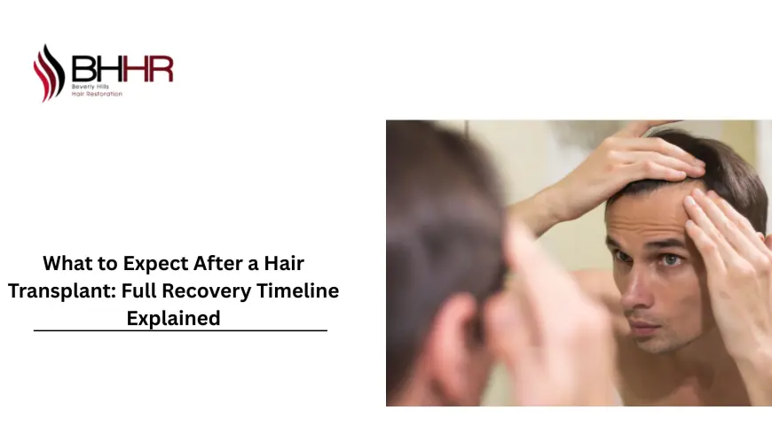 What to Expect After a Hair Transplant: Full Recovery Timeline Explained