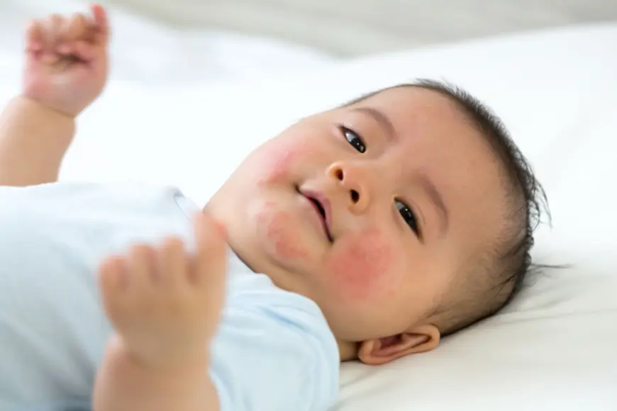 Infant Pollen Allergies: What Every Parent Needs to Know