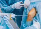 Best Arthroscopy Surgery in India – Cost, Procedure & Recovery Guide