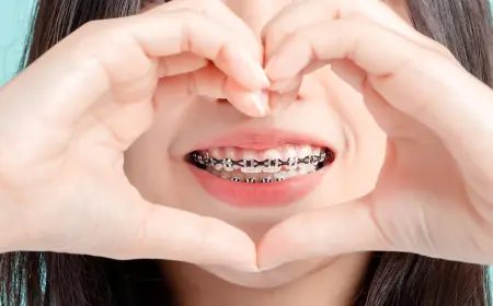 What is the process for getting braces in Islamabad?
