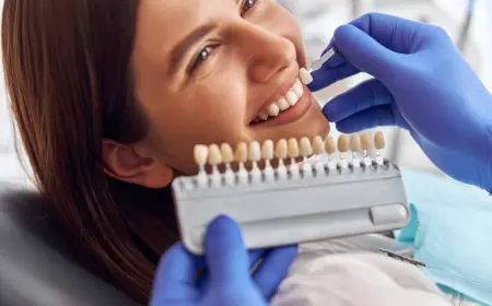 What’s the Recovery Time for Composite Veneers?