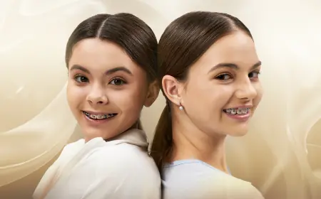 A Smart Spender's Guide to Understanding the Teeth Braces Price in Dubai