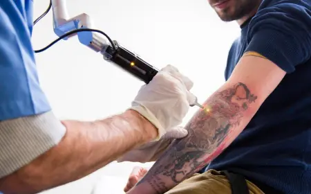 Can Tattoo Removal Cause Scarring? How to Minimize Risks
