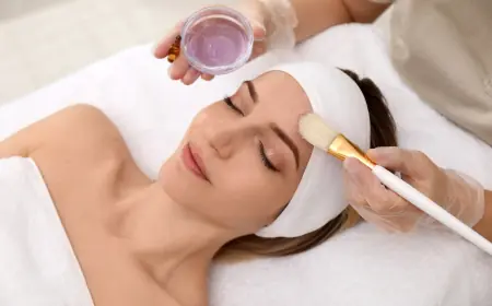 Chemical Peels on a Budget: Affordable Options in Islamabad