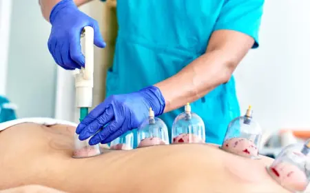 Smart Insights to Reduce Hijama Treatment Cost in Dubai