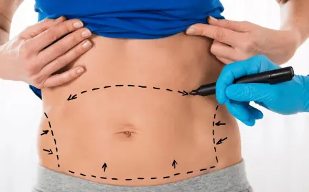 Tummy Tuck in Dubai for Men: Breaking the Stigma